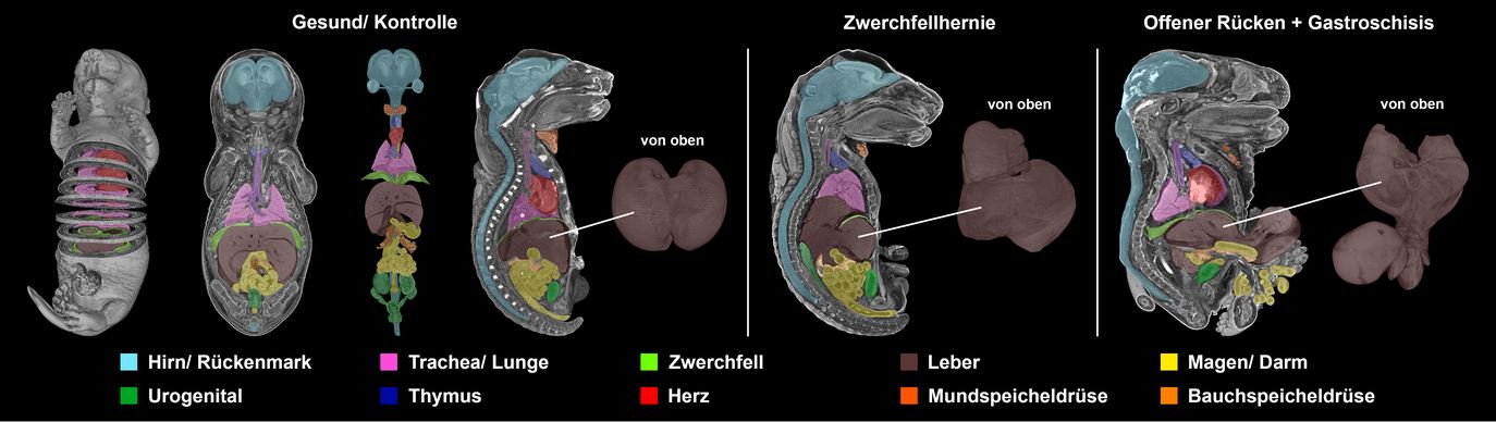 Darstellung eines gesunden Rattenembryo mit segmentierten Organen und zwei fehlgebildete Embryonen mit Missbildungen der Leber.