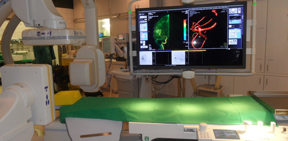Die Eingriffe werden an dieser biplanen neurointerventionellen Angiographieanlage der letzten Generation (Siemens Artis zee) durchgeführt.