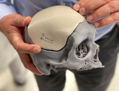 So profitieren Patientinnen und Patienten vom 3D-Druck